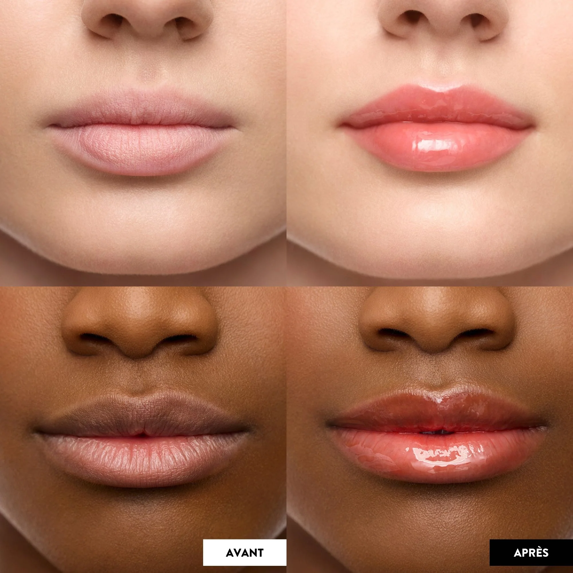 Lip Oil Rehab - Huile à lèvres - Image 25