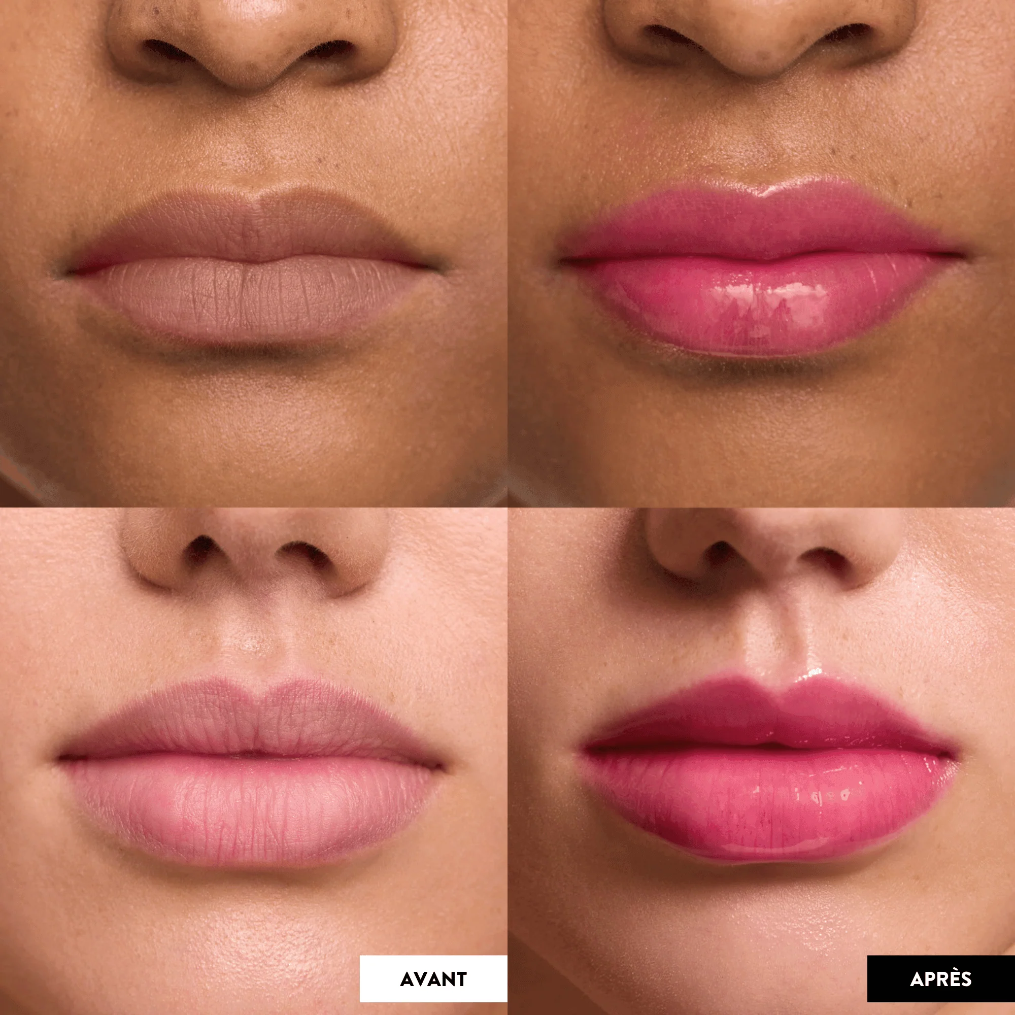 Lip Oil Rehab - Huile à lèvres - Image 9